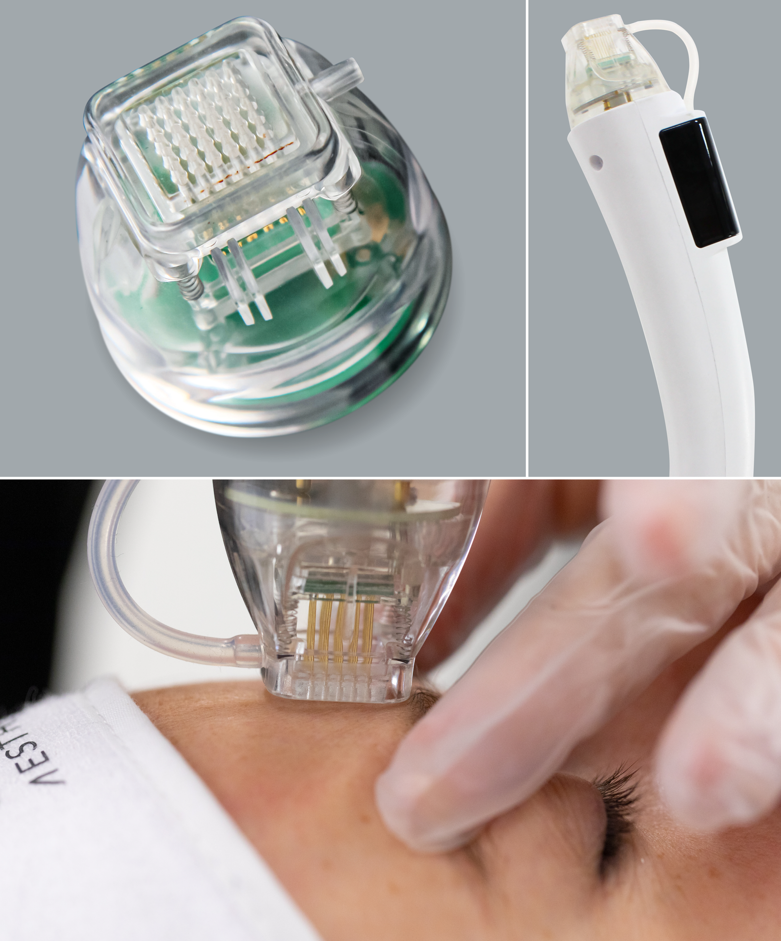 MAR-DMF-WEBIM-HERI-REV03_DMF-Page-Hero-Image-new microneedling